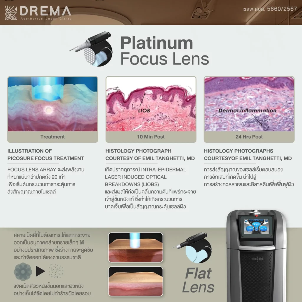 picosure