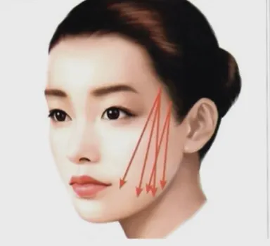 ร้อยไหม